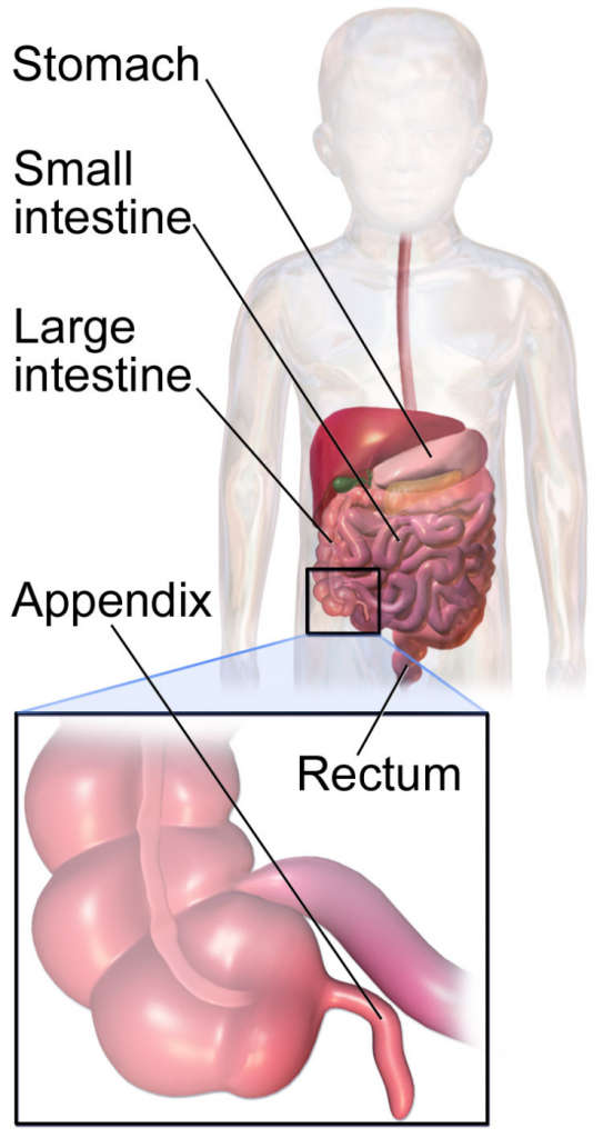 Appendix in Child